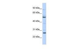 HOXC5 Rabbit anti-Human, Polyclonal, Novus Biologicals 0.1ml; Unconjugated:Antibodies,
